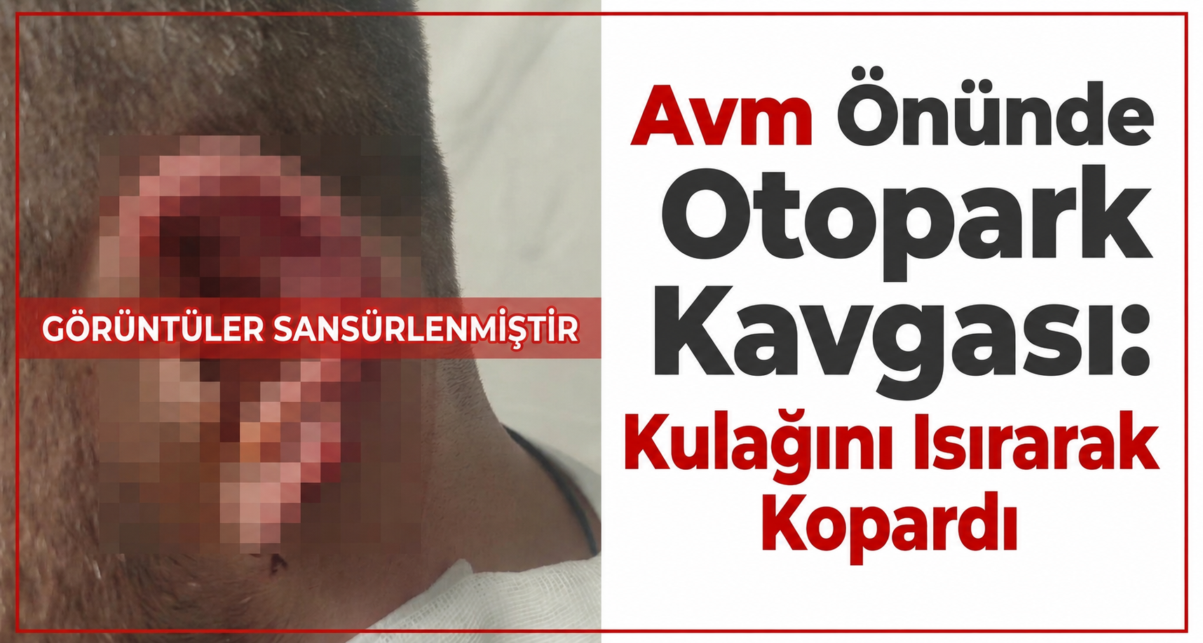 AVM Önünde Otopark Kavgası: Kulağını Isırarak Kopardı