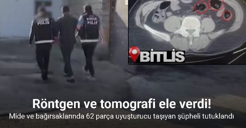 Yolcunun midesinden 62 parça uyuşturucu çıktı