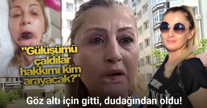 Estetik işlem sonrası dudağı çürüdü, 7 yıldır hukuk mücadelesi veriyor