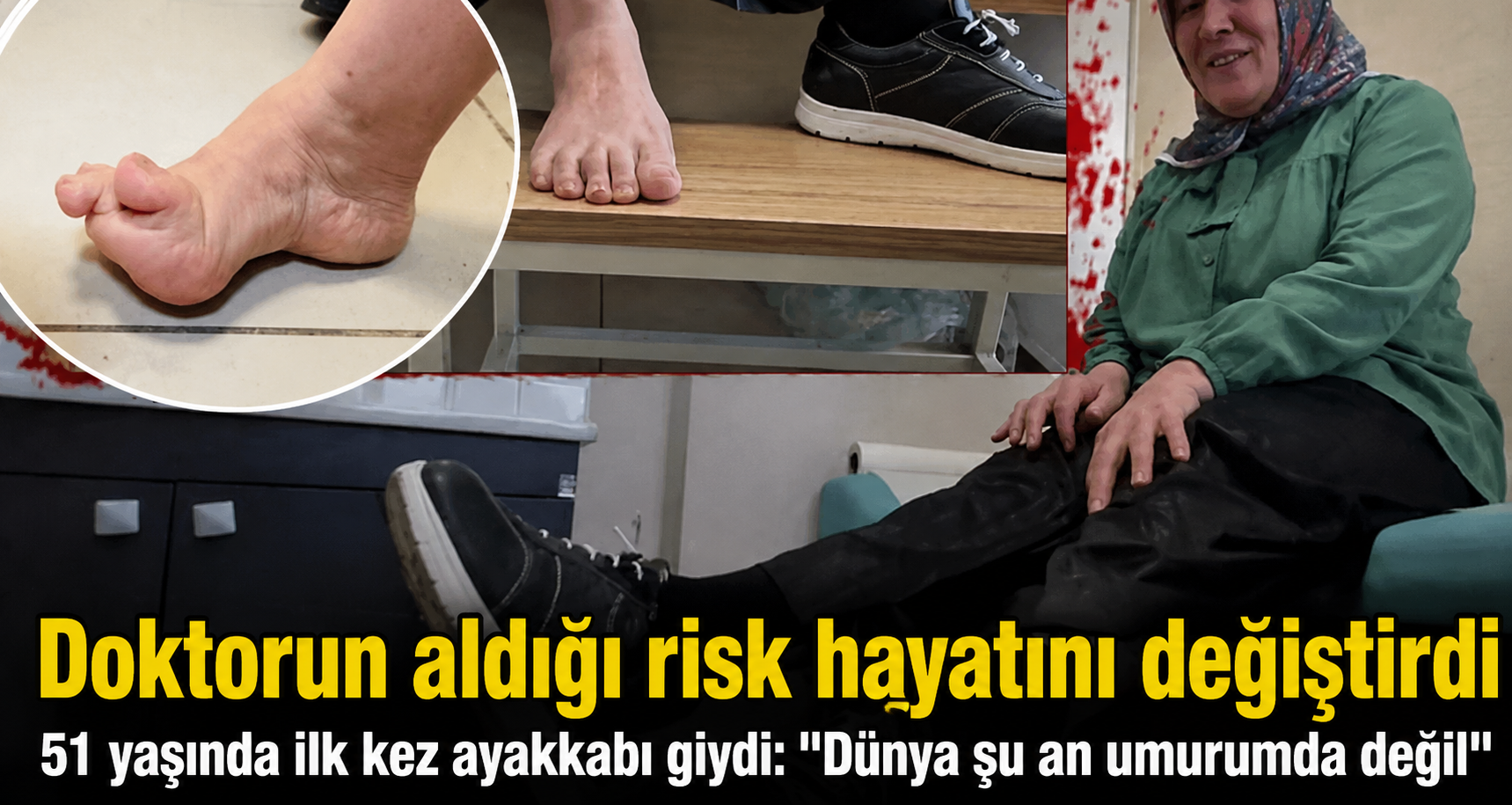 İlk ayakkabısını 51 yaşında giyebildi