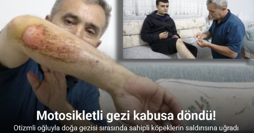 Otizmli oğluyla doğa gezisi sırasında sahipli köpeklerin saldırısına uğradı