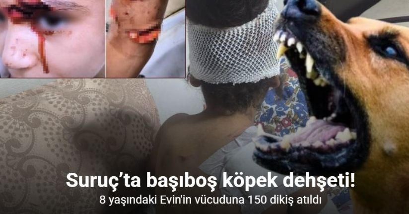 Suruç’ta başıboş köpekler 8 yaşındaki çocuğa saldırdı