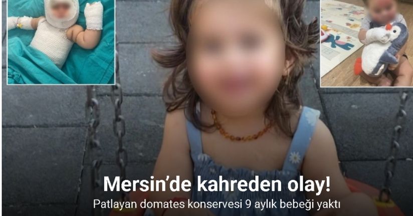 Mersin’de patlayan domates konservesi 9 aylık bebeği yaktı