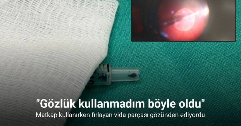 Matkap kullanırken fırlayan vida parçası gözünden ediyordu: 