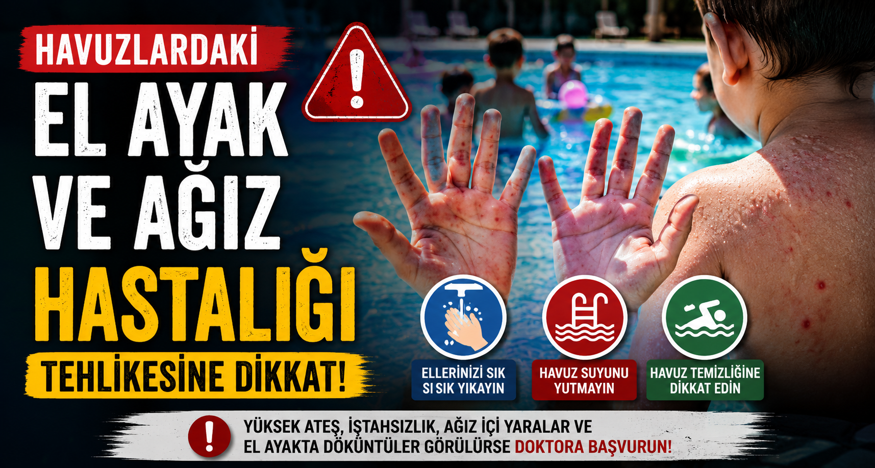 Havuzlardaki el ayak ve ağız hastalığı tehlikesine dikkat