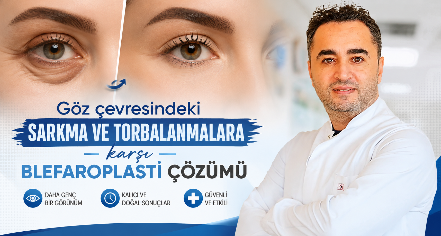 Göz çevresindeki sarkma ve torbalanmalara karşı blefaroplasti çözümü